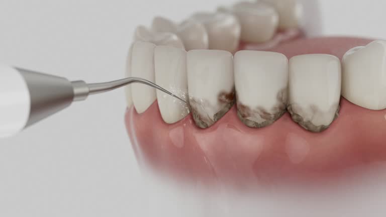 Reliable Dental Implants contractor in Cuero, TX by Smile Center Dentistry